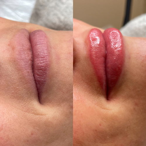 lip blush tattoo before and after